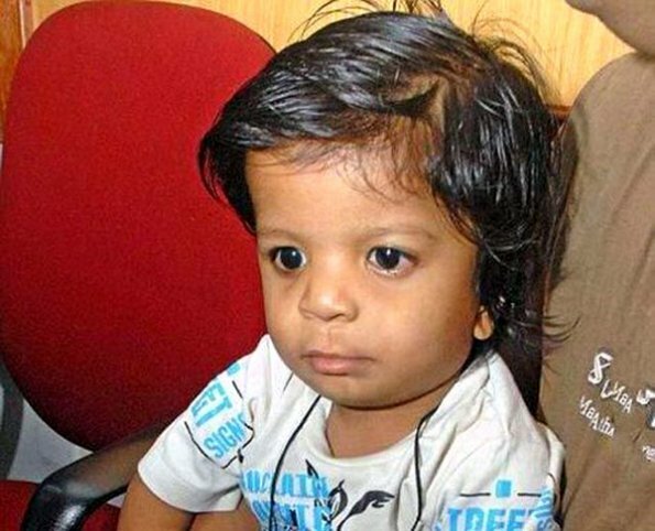 В Индии родился ребёнок с 34 пальцами Мальчик Акшат Саксена из Индии